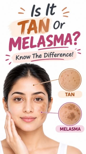 Tanning, Pigmentation, Melasma… What’s the Difference?

Skin pigmentation is not just one condition.