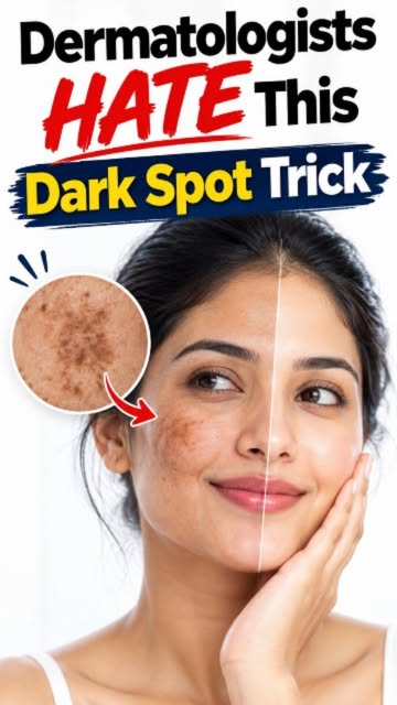 Is One-Time Treatment Enough for Melasma? 🤔

Melasma may reduce with treatment, but it can sometime