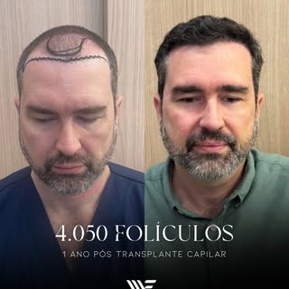 O medo que paralisava o Thiago talvez seja o mesmo que te impede hoje…

Ele queria mudar, mas pensav