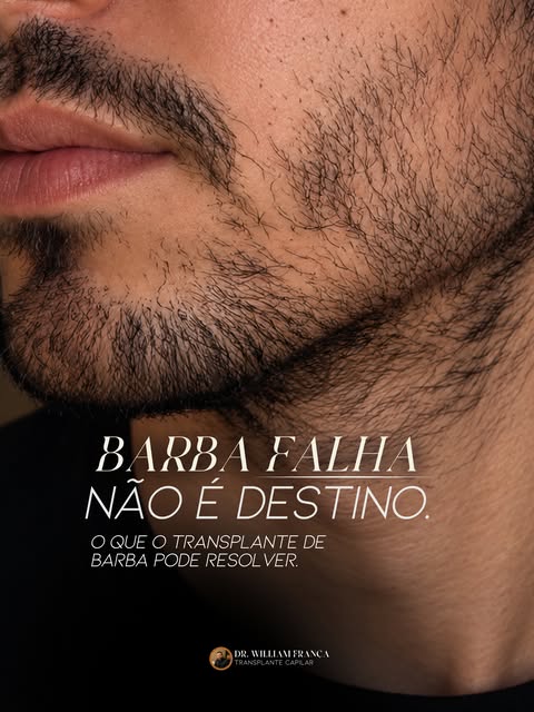 🧔‍♂️ Barba falhando não precisa ser algo definitivo.

Falhas, baixa densidade ou áreas com pouca co