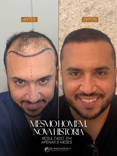 O resultado fala por si. ✨

Um novo contorno, mais densidade e uma linha frontal planejada para resp