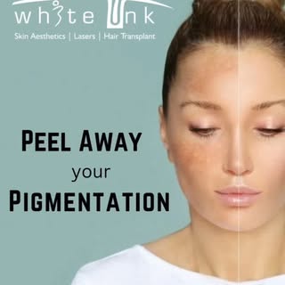 Best #skinglow Treatment in Rajkot 

#skinglow #skinclinic #pigmentation #pigmentationtreatment #ski
