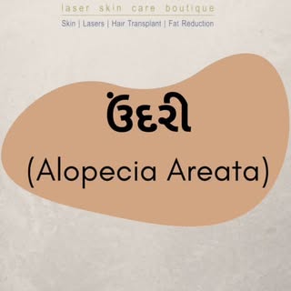 Excellent Result in Alopecia Areata 😍 

#alopecia #areata #skincare #skinclinic #dermatologist #ski