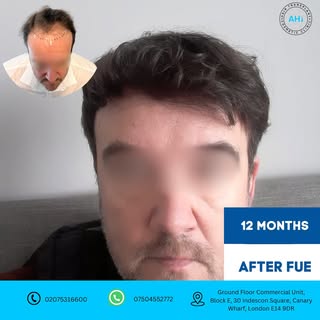 Revitalize Your Look with AHI Clinic! 💇‍♂️✨
Experience the latest in hair restoration at our clinic