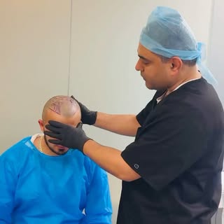 Watch as Dr. Chaudhary explains the intricacies of hairline placement, ensuring natural-looking resu
