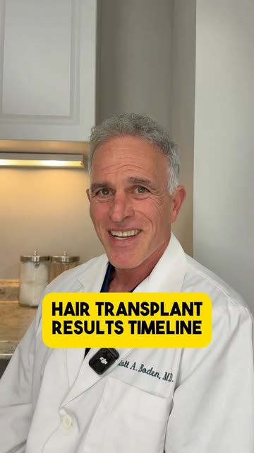 Let’s review the hair growth timeline following a hair transplant procedure! #hairloss #hairtranspla