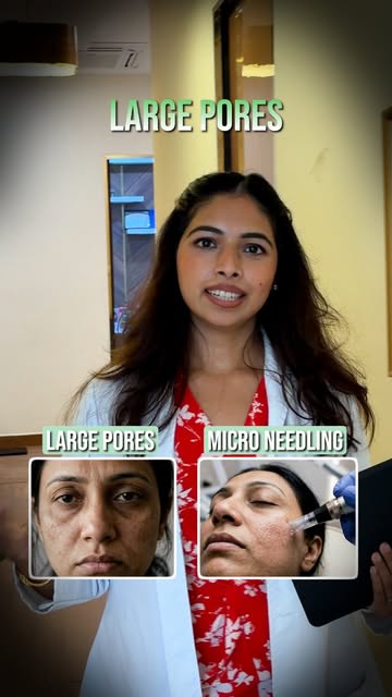 Confused about which skin treatment is right for you? Dr. Aashritha breaks it down! From tanning to 