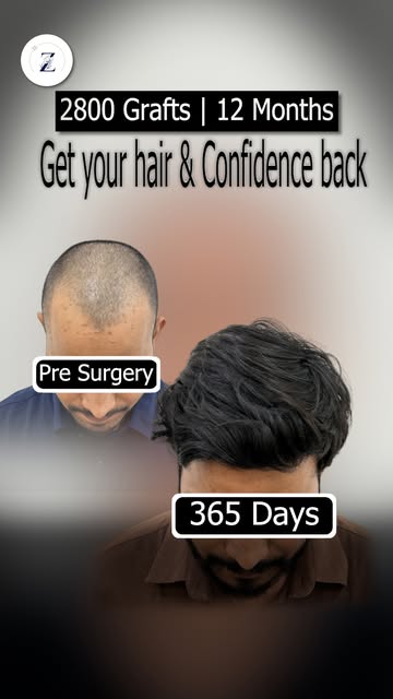 From thinning to thriving, watch confidence find its way back!

Behind every remarkable transformati