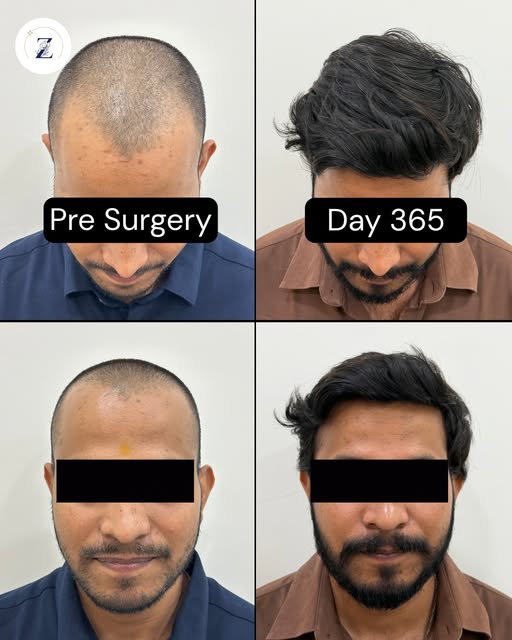 When thinning hair starts holding you back, taking matters into your own hands is the ultimate power