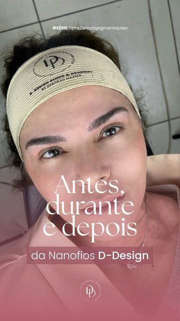 O antes e depois mostra a transformação. Mas o durante mostra o que sustenta o resultado.

Nos Nanof
