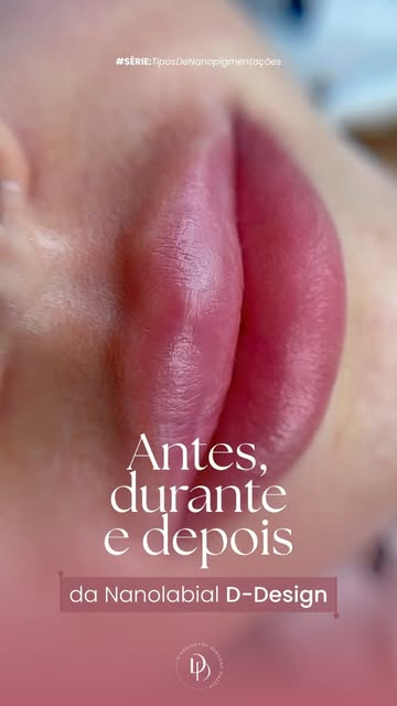 O Nanolabial natural não começa na cor. Começa na leitura da pele, dos lábios e do rosto.

Antes do 