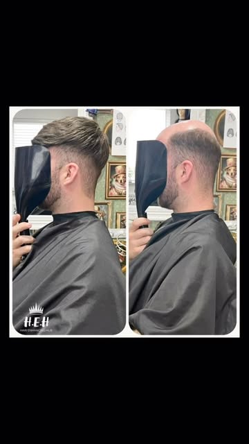 👏🏼 Unreal Transformation For My Gorg New Client ‘CP’: 10/09/2026
.
🌟 www.hehub.uk 🌟
.
Adhesion M