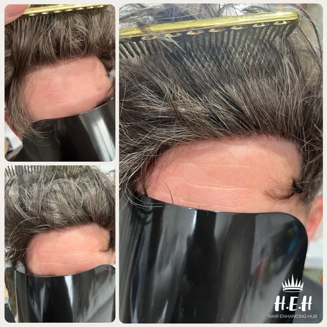 Flawless New Hairline! 🫶🏻🩵🫶🏻🩵🫶🏻
.
⭐⭐⭐ www.hehub.uk ⭐⭐⭐
.
✅ Bespoke Hair Systems (Hybrid & La