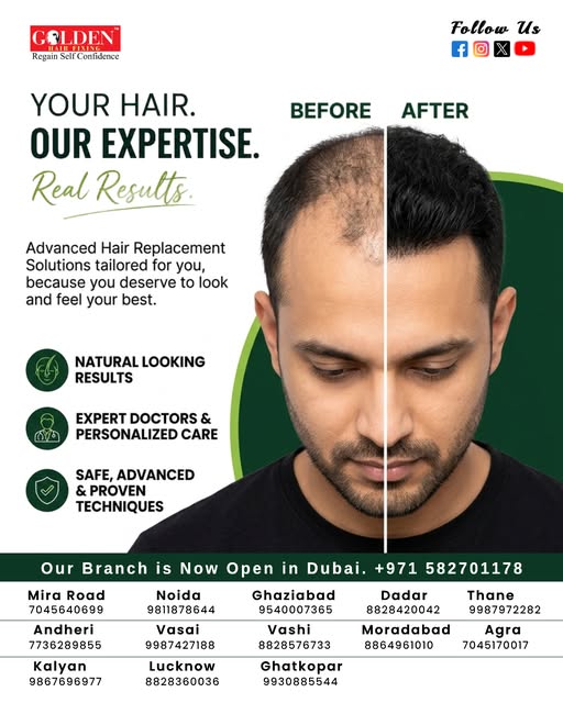 Your Hair. Our Expertise. Real Results. ✨

Advanced hair replacement solutions tailored just for you