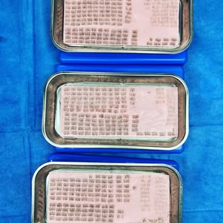 Precious grafts! 

1 day procedure, ~ 4700 grafts.