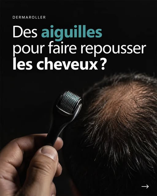 Le dermaroller est devenu très populaire sur les réseaux sociaux. Son principe : faire rouler de min