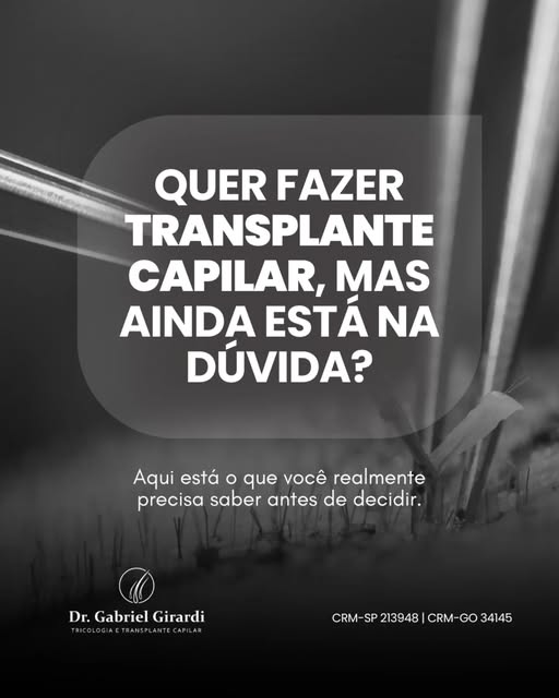 Se você pensa em fazer um transplante capilar, mas ainda está inseguro, saiba que isso é mais comum 