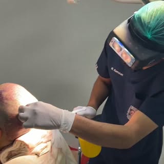 #HairTransplant #foryou #plasticsurgery #viral #cosmeticsurgery