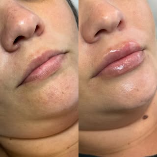 ✨O natural não sai de moda! ✨

Continuando com o nosso quadro: toda sexta teremos um antes e depois 