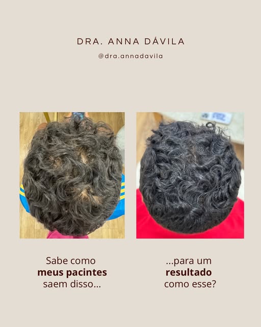 Resultado lindo e que mostra a diferença que um tratamento direcionado pode fazer. 

De um cabelo ma