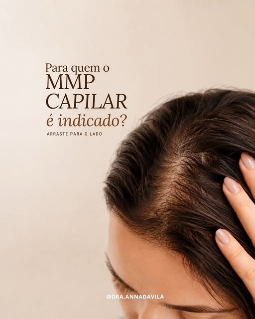 Quando pensamos em tratamento capilar, é comum associarmos imediatamente à alopecia. Mas você sabia 