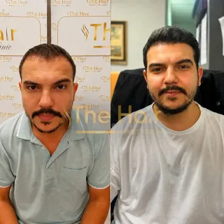 9 Aylık Değişim ✨

9 ay önce başlayan bu yolculukta, danışanımızın kendi paylaşımıyla bugün geldiğim