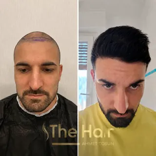 8 Aylık Değişim ✨

8 ay önce başlayan sürecimizin güzel bir sonucu daha!
Danışanımızdan gelen bu değ