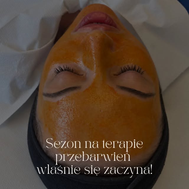 SEZON NA TERAPIE PRZEBARWIEŃ WŁAŚNIE SIĘ ZACZYNA!

Jesień to idealny moment, by przyjrzeć się skórze