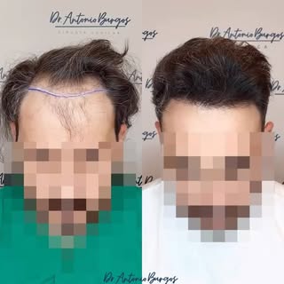 Vamos terminando nuestra última semana antes de las vacaciones con el día de hoy de consultas de nue
