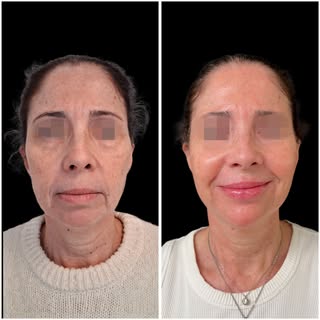 ✨ Hay un tipo de cambio que nos encanta conseguir…

Ese momento en el que nuestras pacientes vuelven