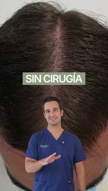 8 meses de diferencia.
Sin cirugía.
Sin injerto.

Cuando todavía existe pelo, aunque sea fino y debi