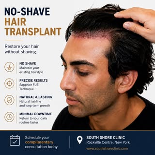 Think you need to shave your head for a hair transplant? Think again.

At South Shore Clinic, preser