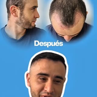 💙 Un resultado que habla por sí solo.

Conocer la experiencia de nuestros pacientes y ver su evoluc