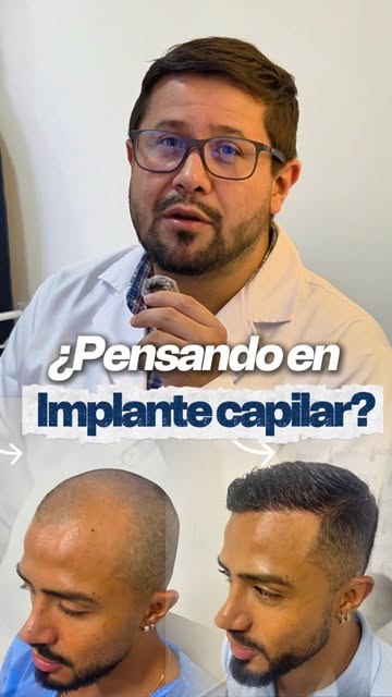 ¿Cuánto tiempo llevas pensando en hacerte un implante capilar? 👀

A veces esperamos el momento perf