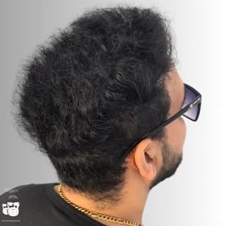 While you still have some of your hair, it's a good idea to reduce the stress that an empty scalp ca