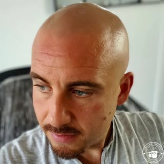 When you want to blend seamlessly with the tones of your shaved sides and the areas where hair once 