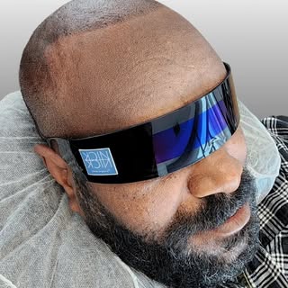 If you’re not feeling confident about the scars from your hair transplant and you want to add more d