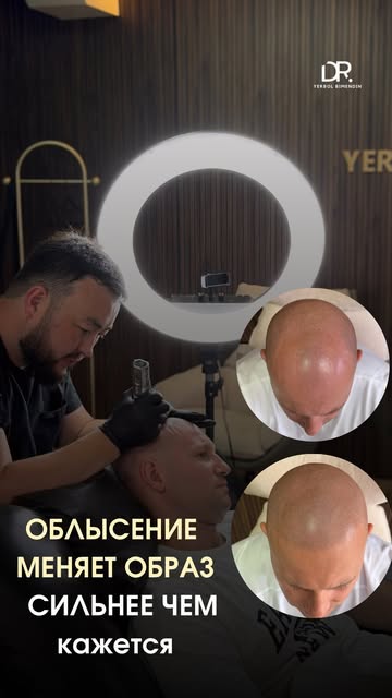 Можно хорошо выглядеть, следить за собой, быть уверенным в себе. Но облысение всё равно меняет образ