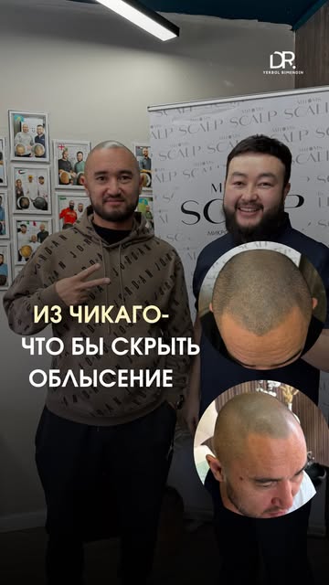 Из Чикаго — чтобы исправить проблему облысения ✈️

Ранее клиент уже делал микропигментацию кожи голо