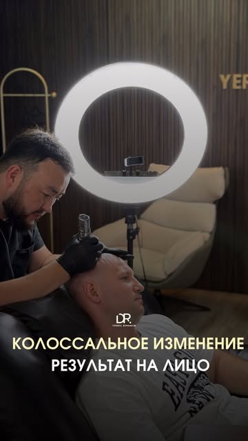 «Колоссальное изменение» — именно так клиент описал свой результат после SMP.

Облысение долго влиял