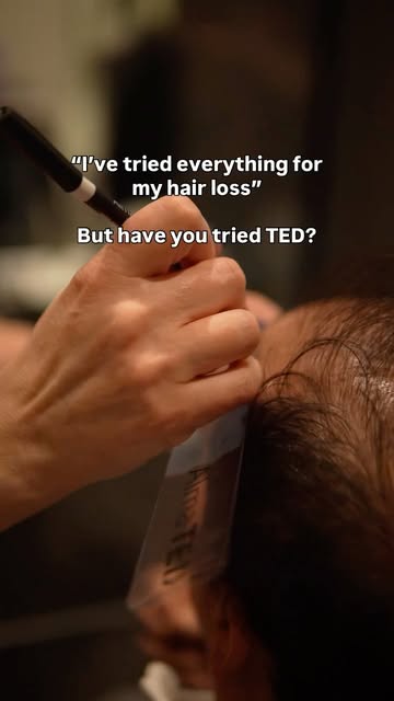 “but I’ve tried EVERYTHING for my hair loss.”

the shampoos.
the supplements.
the oils.
the serums.
