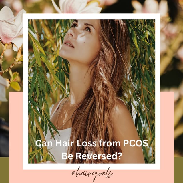 💭 Can hair loss from PCOS be reversed?

PCOS-related hair thinning can have different causes, and t