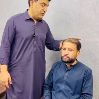 Hair Transplant Repair Case | Straight “Operated” Hairline + Low Density

Hair Transplant Repair Ass