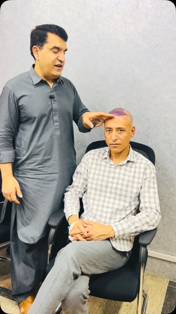 A Wise Decision | Mature Natural Hairline Instead of Teenage Hairline

Sapphire FUE by Dr Noor Ali K