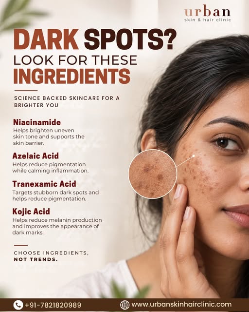 Dark spots don’t need random trends — they need the right ingredients. ✨

Look for proven skincare a