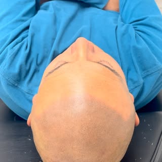 From being COMPLETELY bald on top. To be told “nice haircut” while walking out the office.