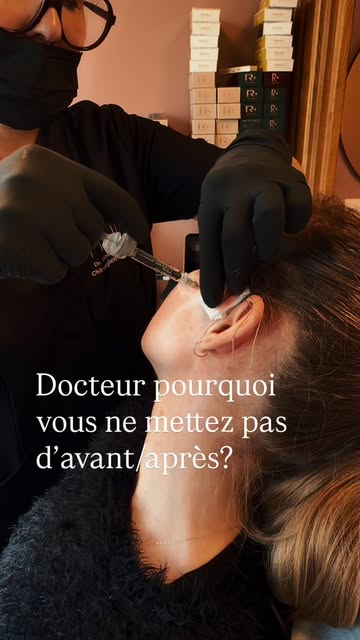 On nous pose souvent cette question : Dr pourquoi est ce que vous ne mettez pas assez d’Avant-Apres?
