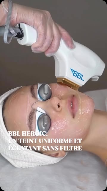 Votre peau se souvient de chaque été. Le BBL, lui, l’aide à oublier.

Taches brunes, rougeurs diffus