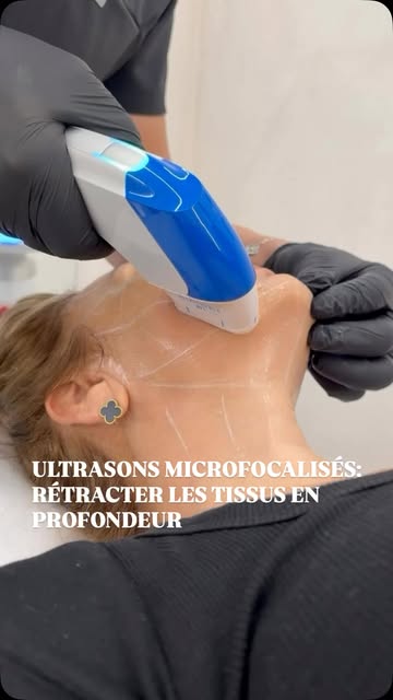 Redessiner l’ovale du visage et retendre les tissus sans chirurgie ni éviction sociale: c’est tout l