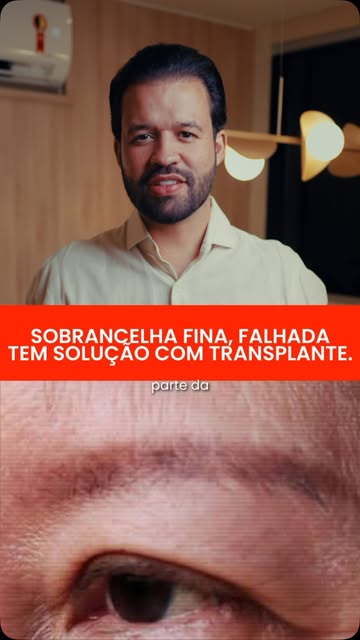 TRANSPLANTE DE SOBRANCELHAS: FICA NATURAL? 👀

Quando bem planejado, o resultado pode ser extremamen